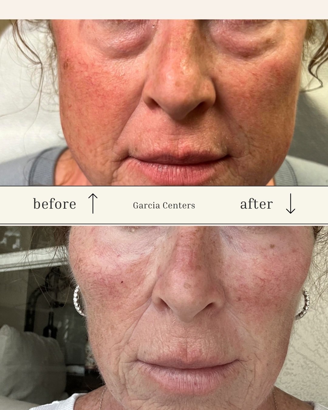 Ariessence Pure PDGF+ | Garcia Aesthetics