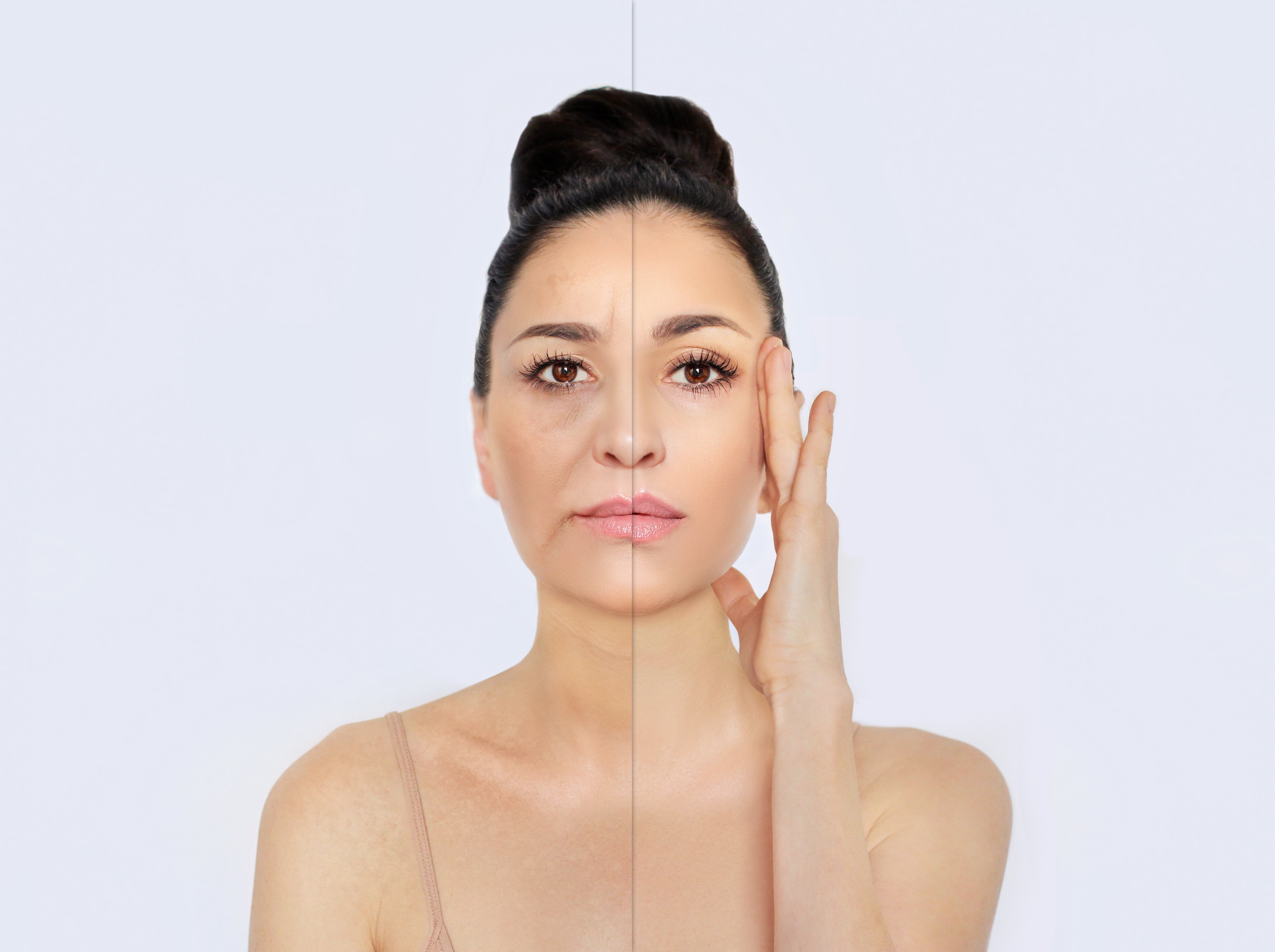 Anti-Aging