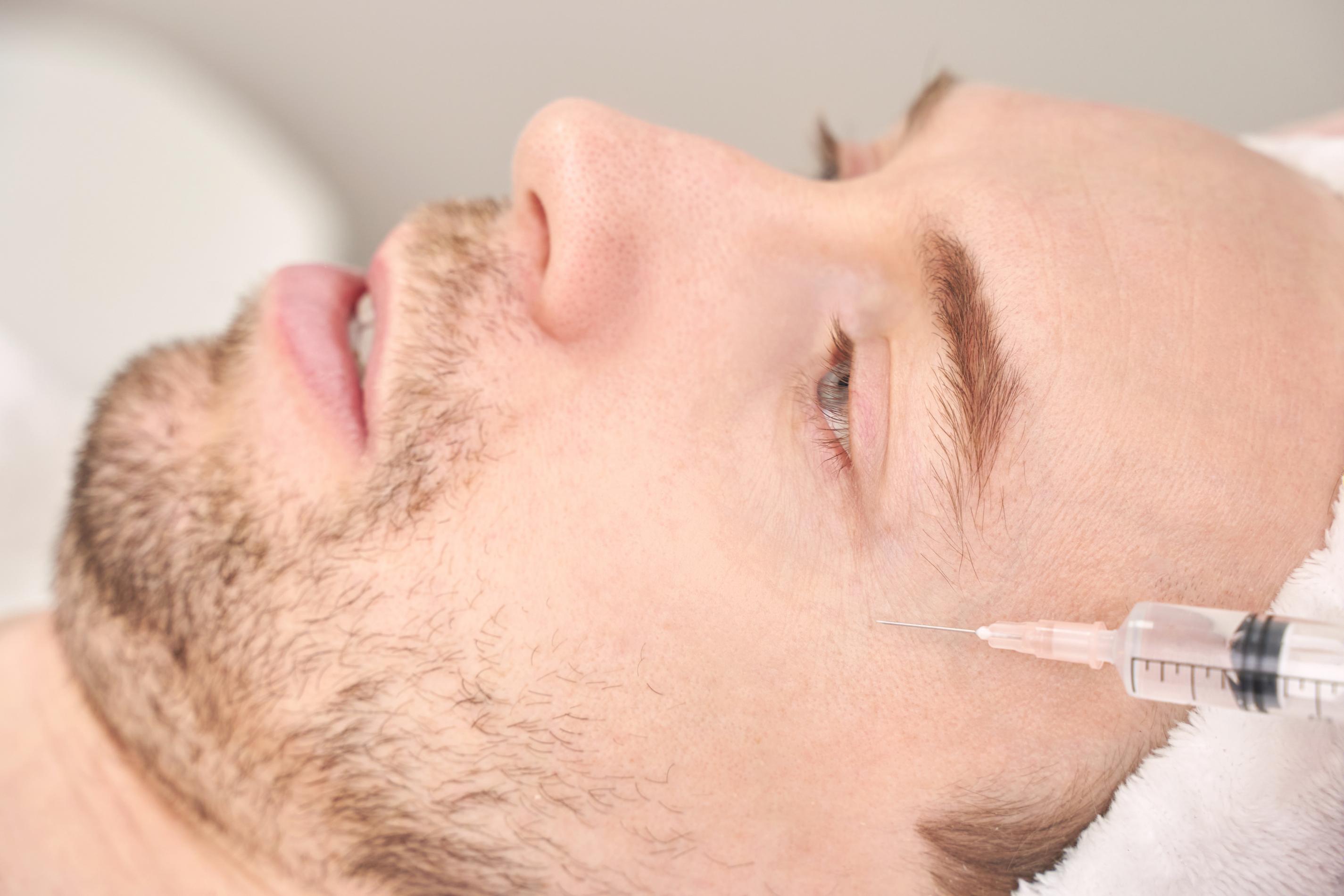man receiving dermal filler