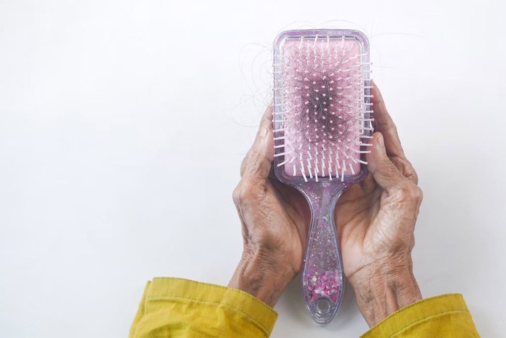 PDGF Therapy for Hair Loss: Is It the Best Non-Surgical Solution?